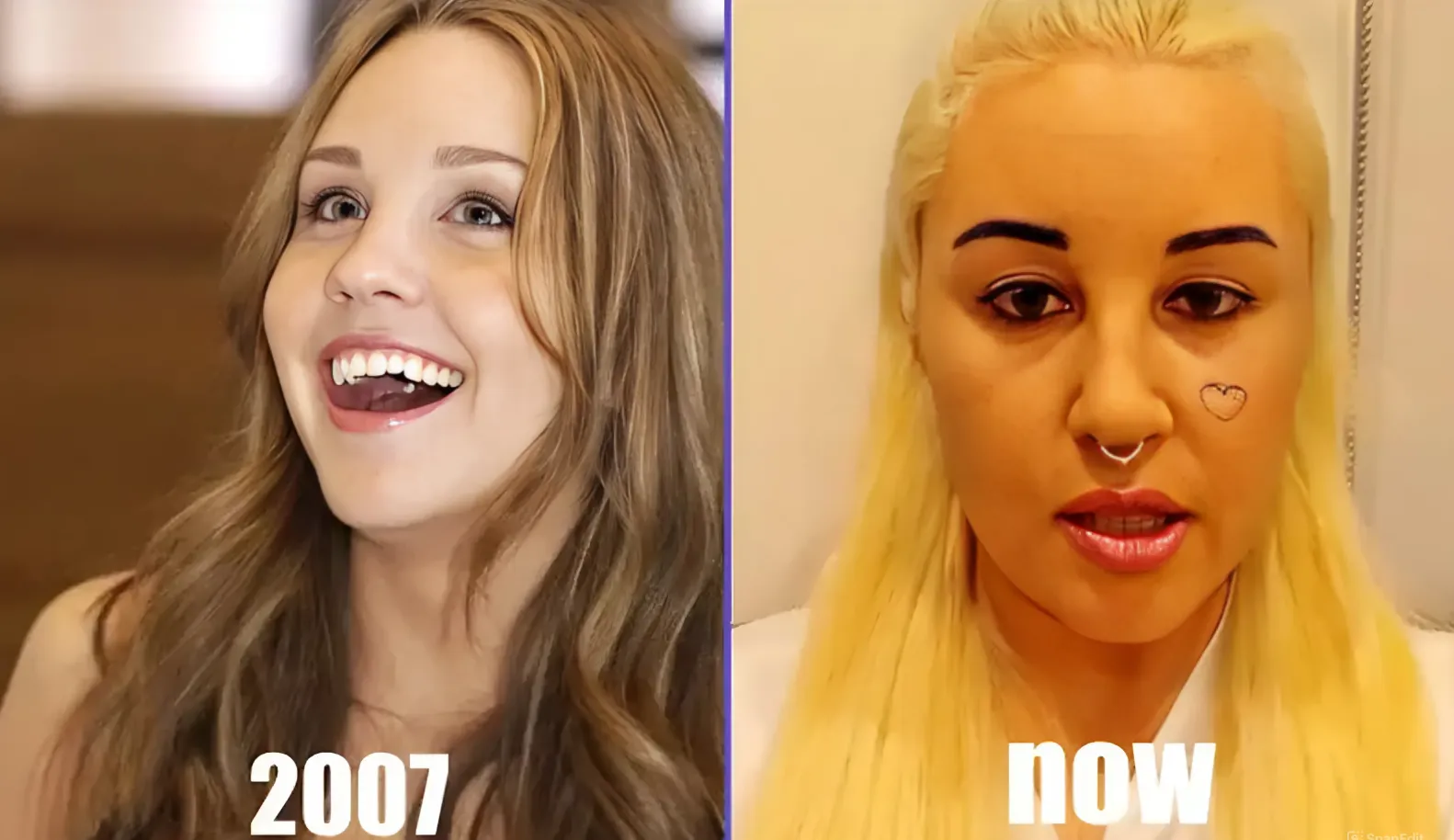 Breaking down every reason Patrick Mahomes was snubbed for 2025 NFL Pro Bowl