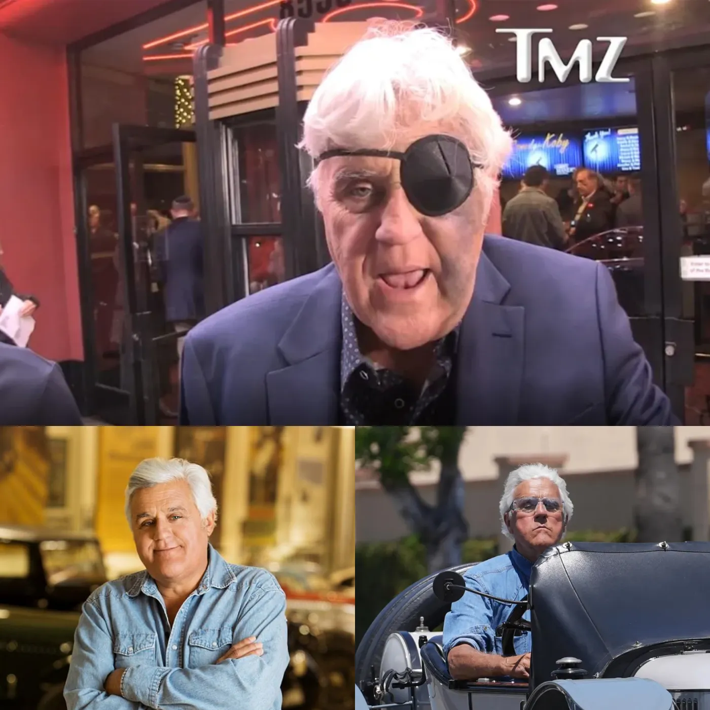 Jay Leno - "Bruised All Over" After Terrifying Fall, Face Disfigured