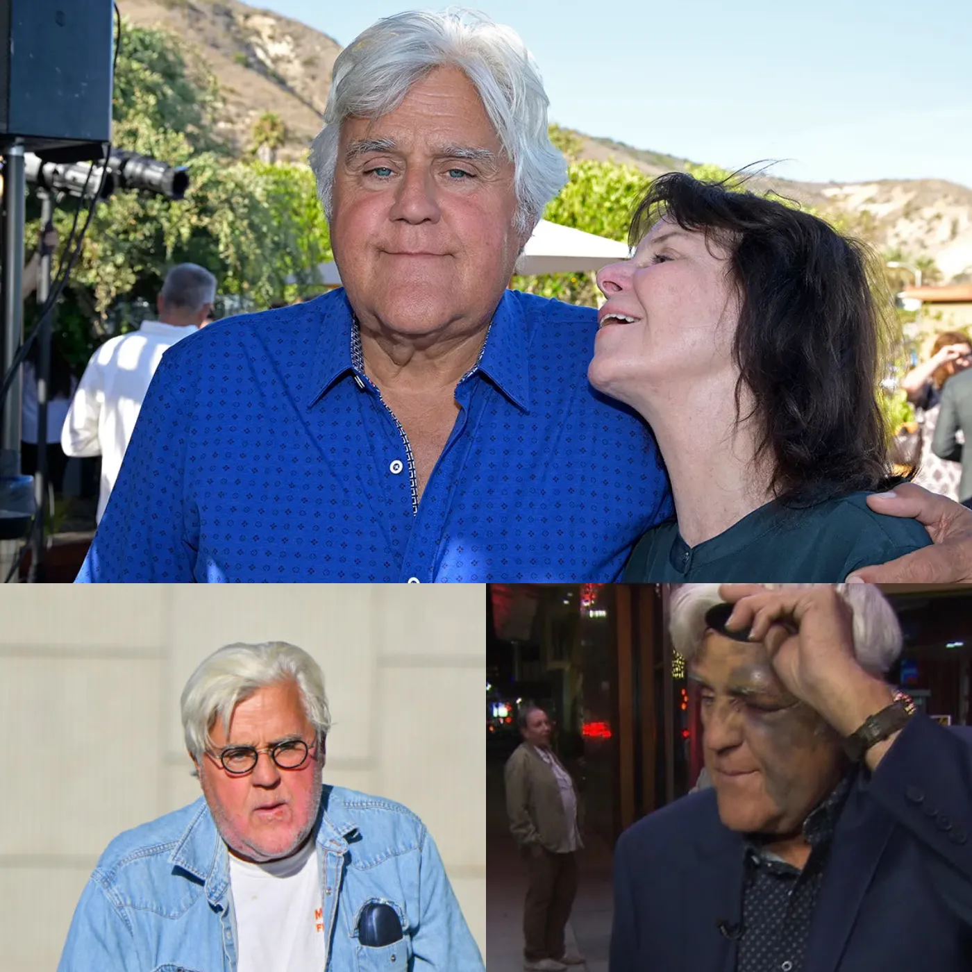 Severe Accident - Jay Leno Hospitalized in Critical Condition