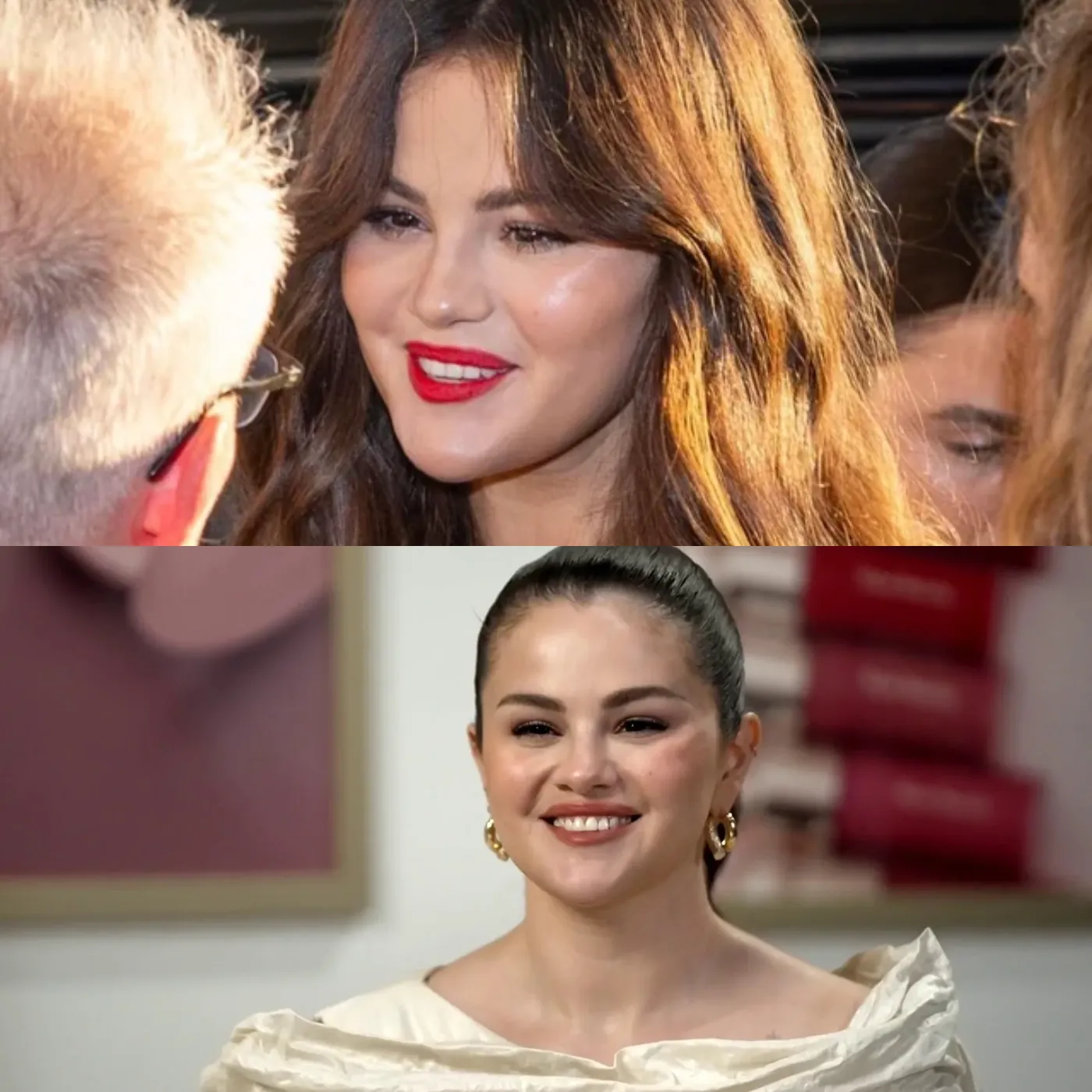 Selena Gomez's Alleged Failed Cosmetic Surgery And The Truth Behind the Rumors