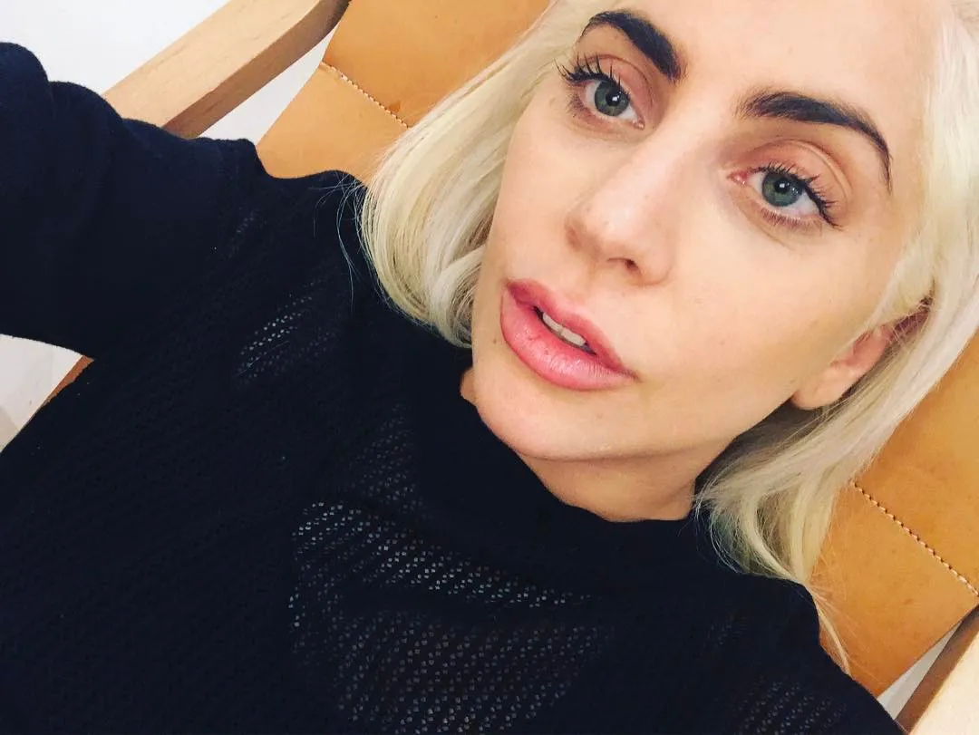 Shock: Lady Gaga Faces Life-Threatening Danger After Surgery!