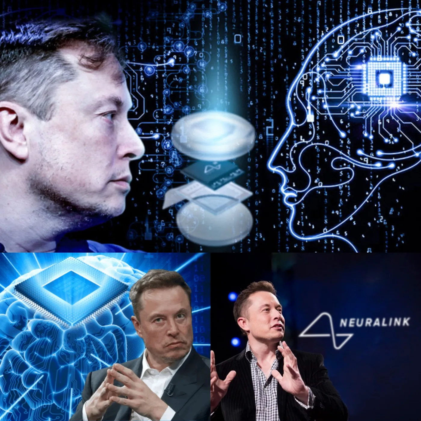 Canada Approves Elon Musk's Neuralink to Trial Brain Chip Implant in Humans