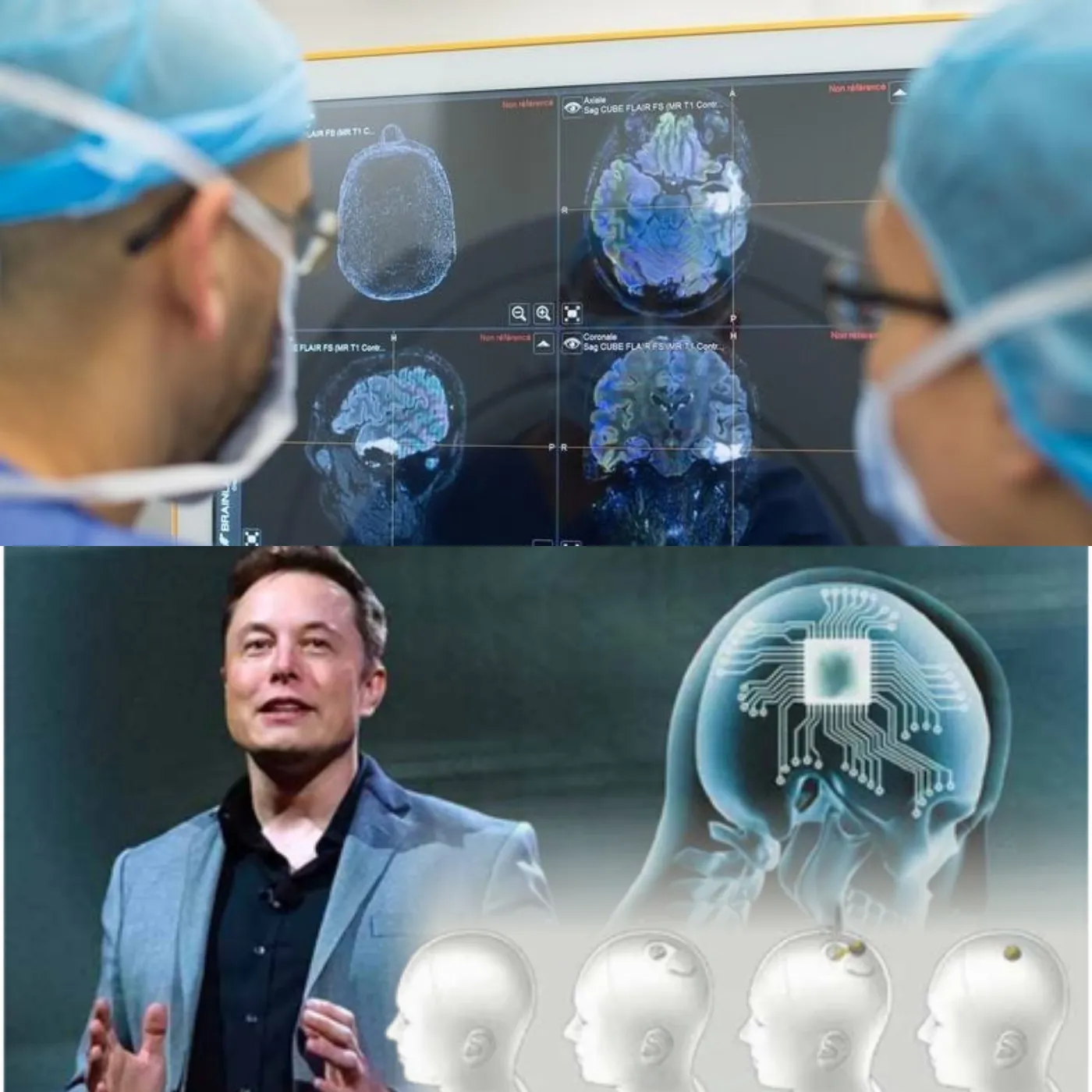 Canada Approves Elon Musk's Neuralink to Trial Brain Chip Implant in Humans