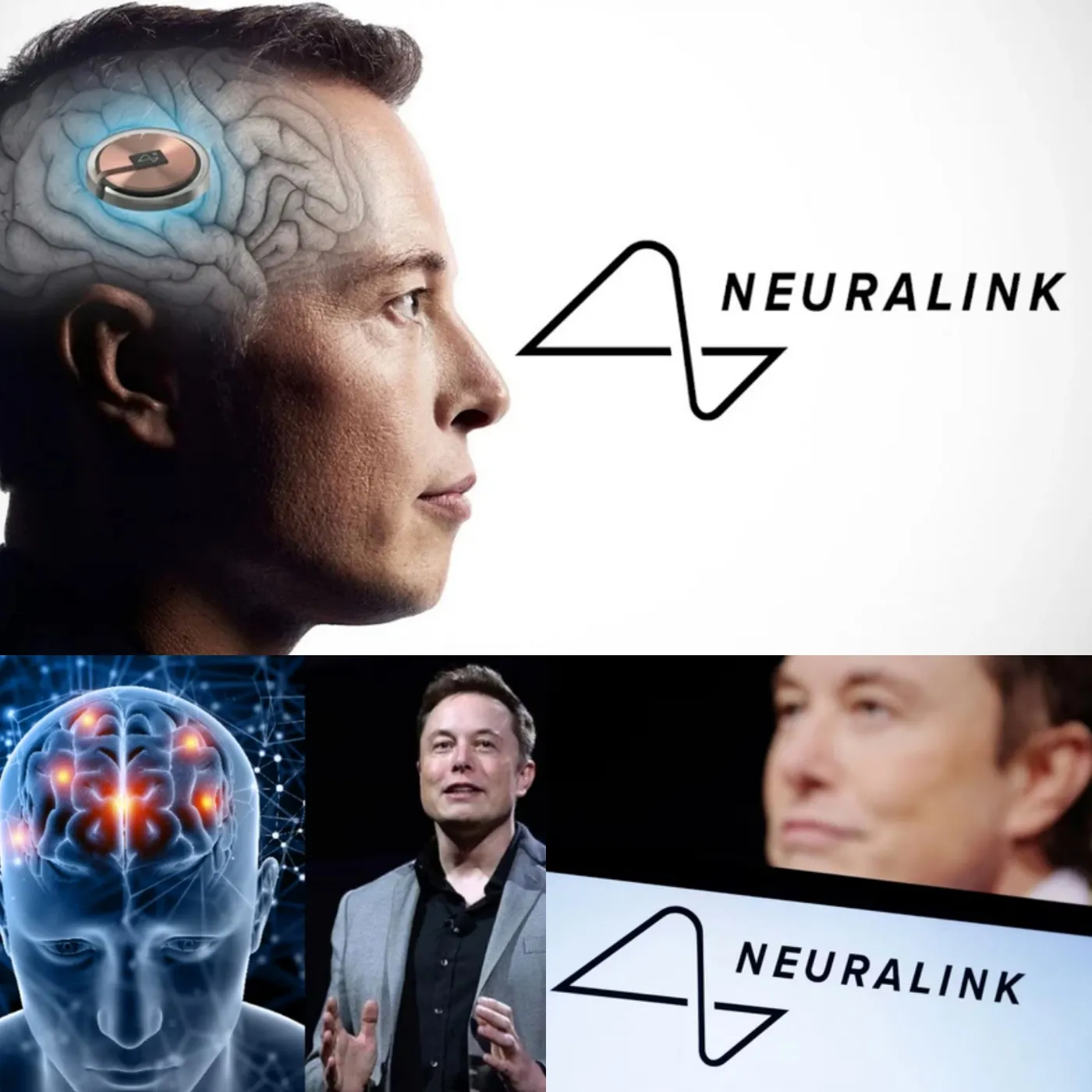 Canada Approves Elon Musk's Neuralink to Trial Brain Chip Implant in Humans