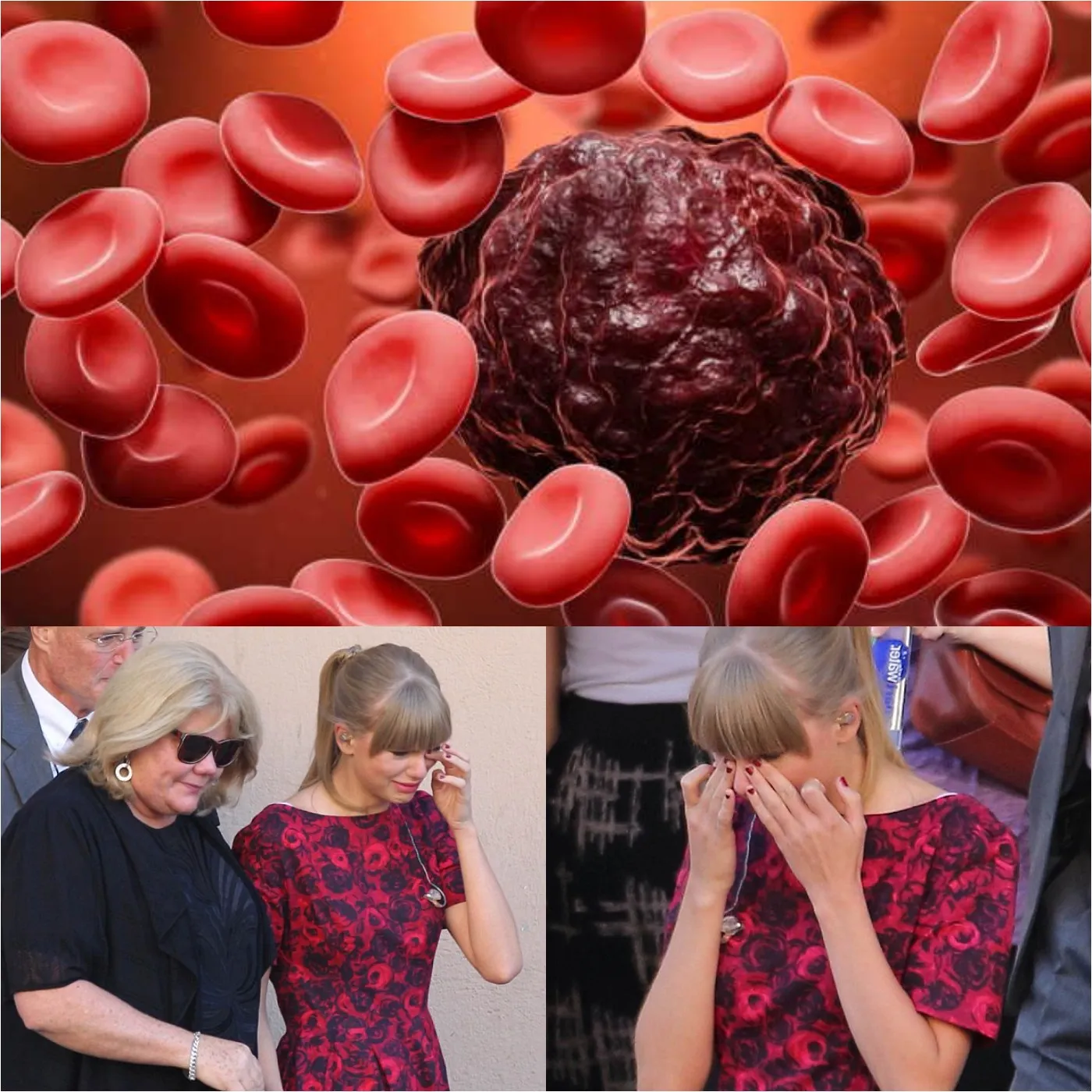 Taylor Swift Says There Is Not Much Time Left in Her Leukemia Battle