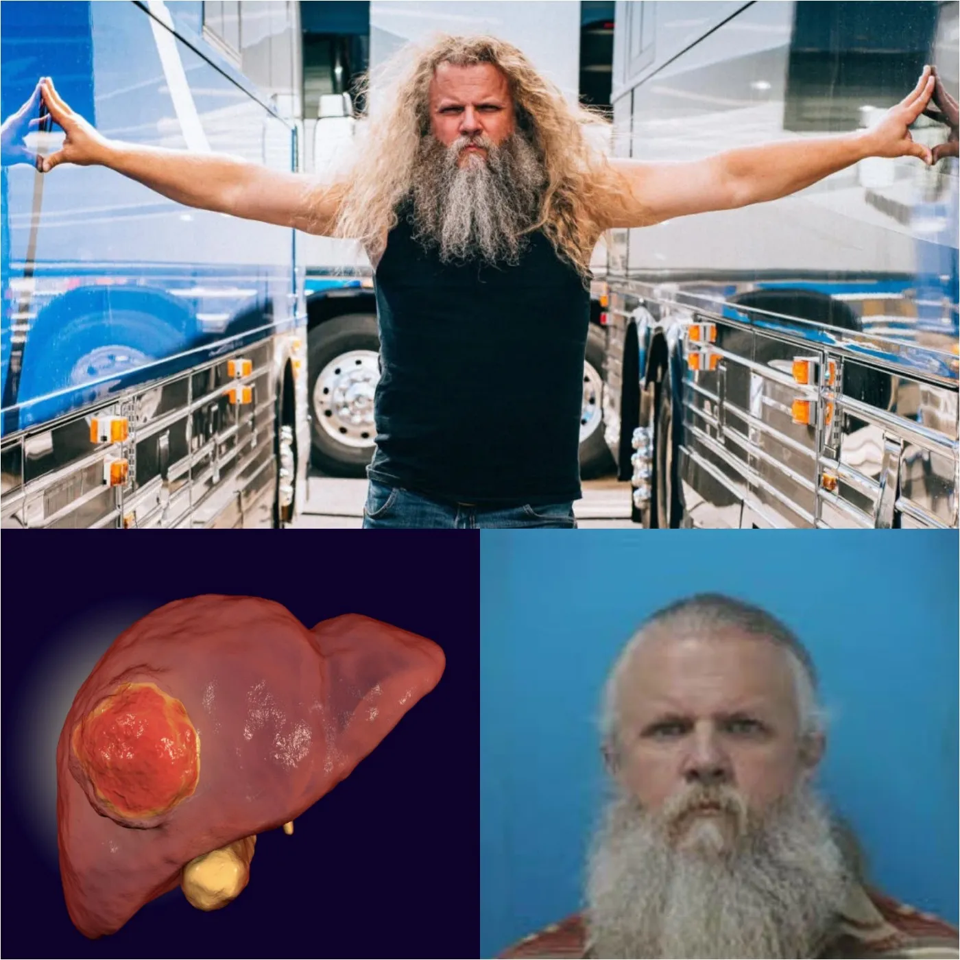 Amid a drug possession controversy, country singer Jamey Johnson discloses that she has terminal liver cancer. 2 Amid a drug possession controversy, country singer Jamey Johnson discloses that she has terminal liver cancer.