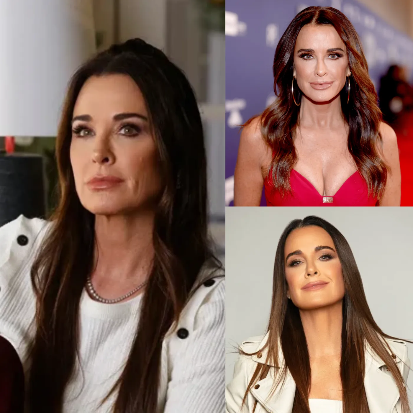 Kyle Richards Disgusted by Dorit Kemsley’s “bad” plastic surgery