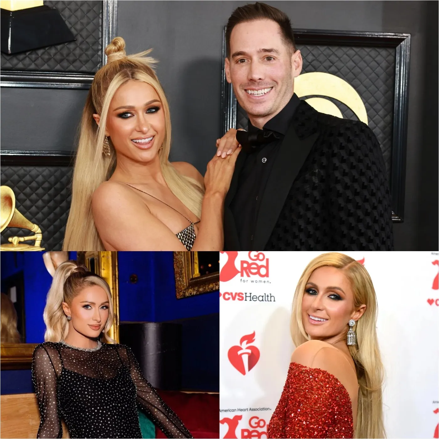 Paris Hilton, 43, Insists She Has 'Never Done Any Botox, Injectables, No Surgery' 3 Paris Hilton, 43, Insists She Has 'Never Done Any Botox, Injectables, No Surgery'