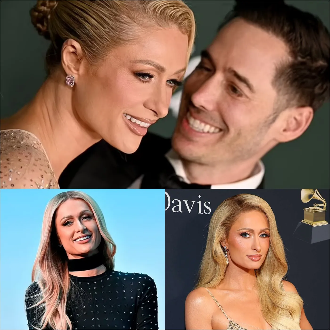 Paris Hilton, 43, Insists She Has 'Never Done Any Botox, Injectables, No Surgery'