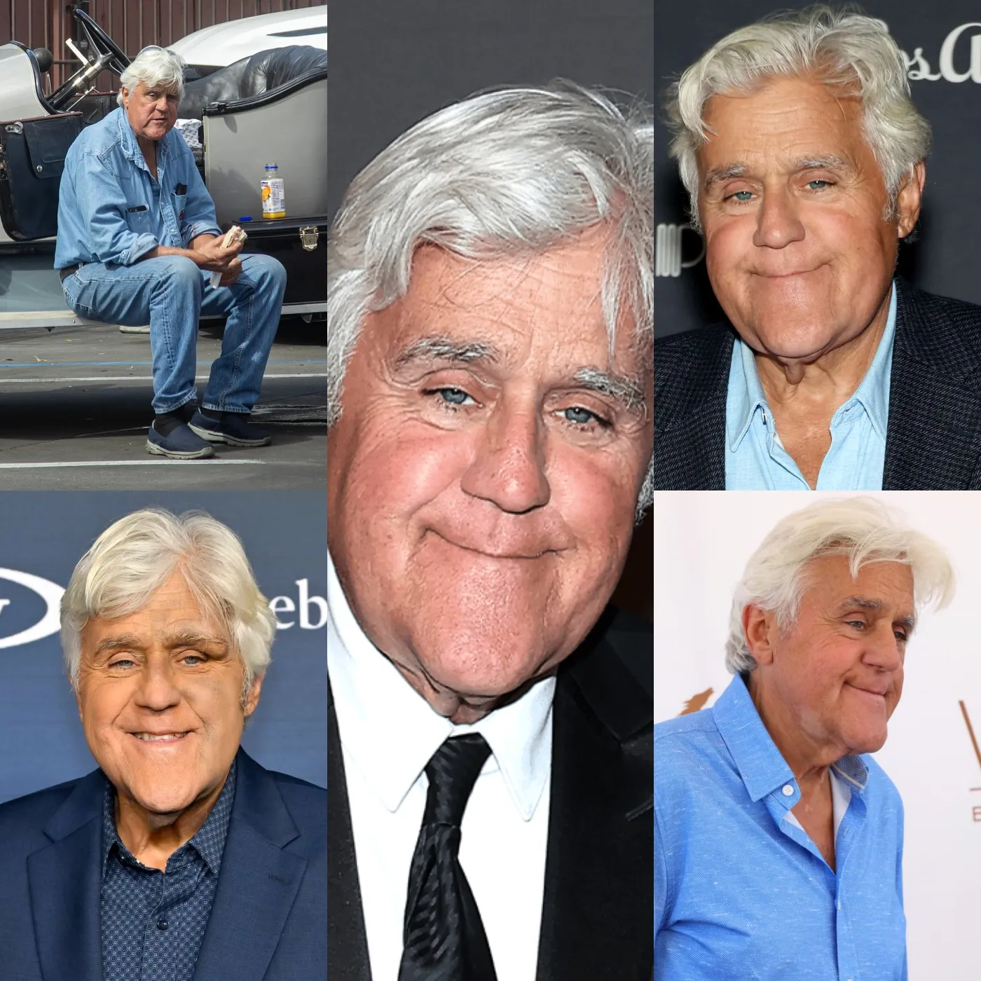 Jay Leno Recovering After Serious Fall: Smiling Through the Pain