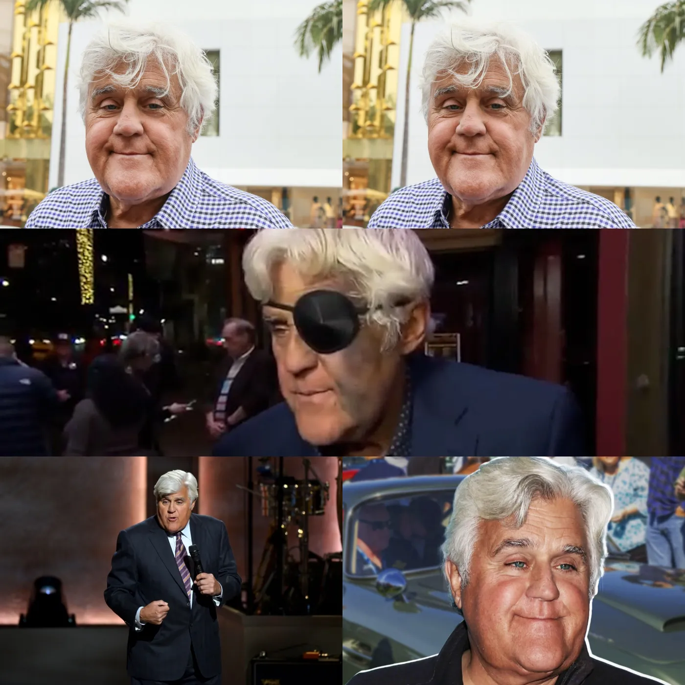 Jay Leno Recovering After Serious Fall: Smiling Through the Pain
