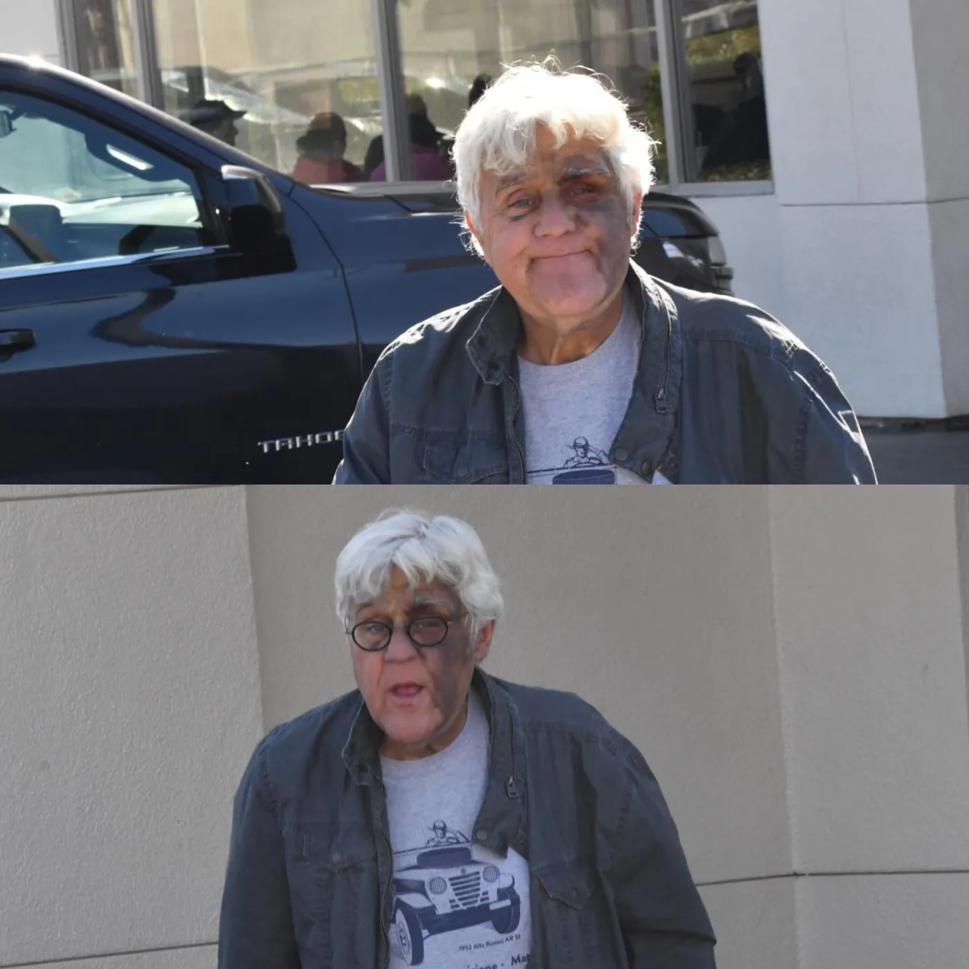 Jay Leno Recovering After Serious Fall: Smiling Through the Pain
