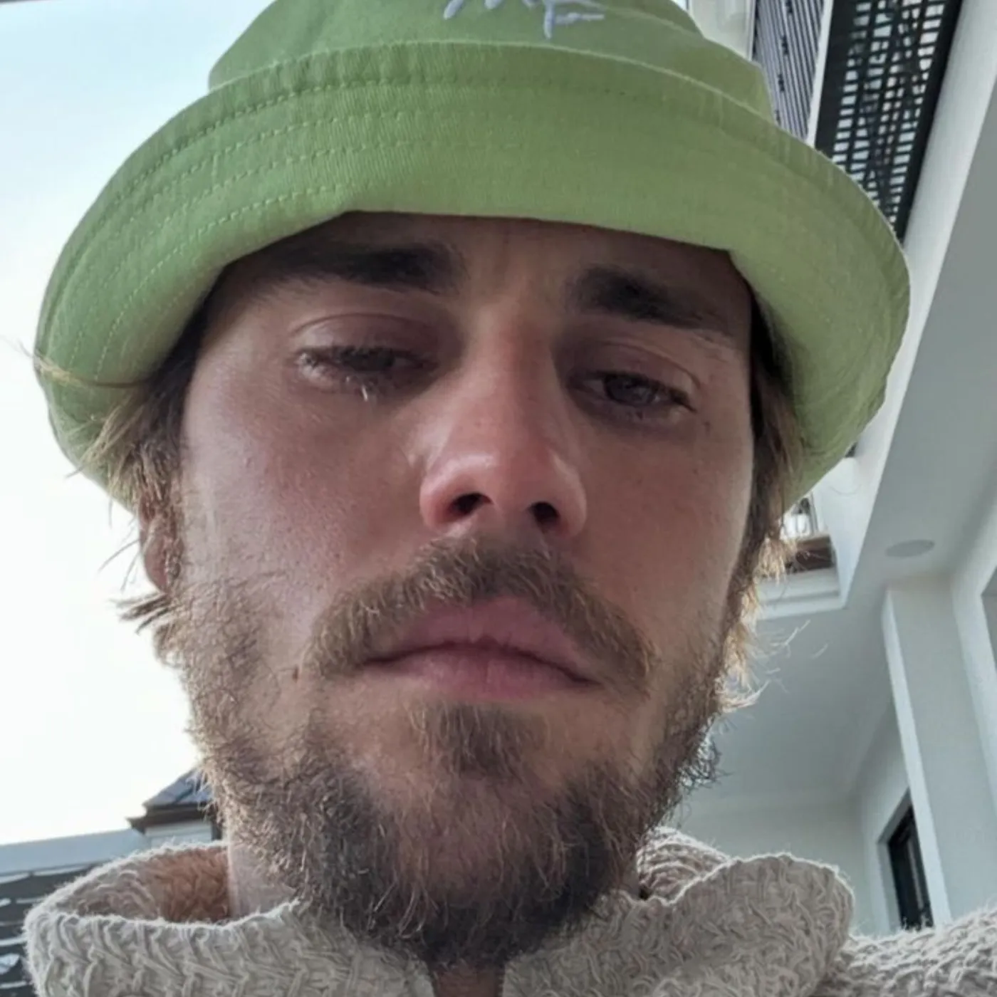 Justin Bieber’s Financial Woes: Is He Headed Back on Tour to Pay for His Health Crisis? 2 Justin Bieber’s Financial Woes: Is He Headed Back on Tour to Pay for His Health Crisis?