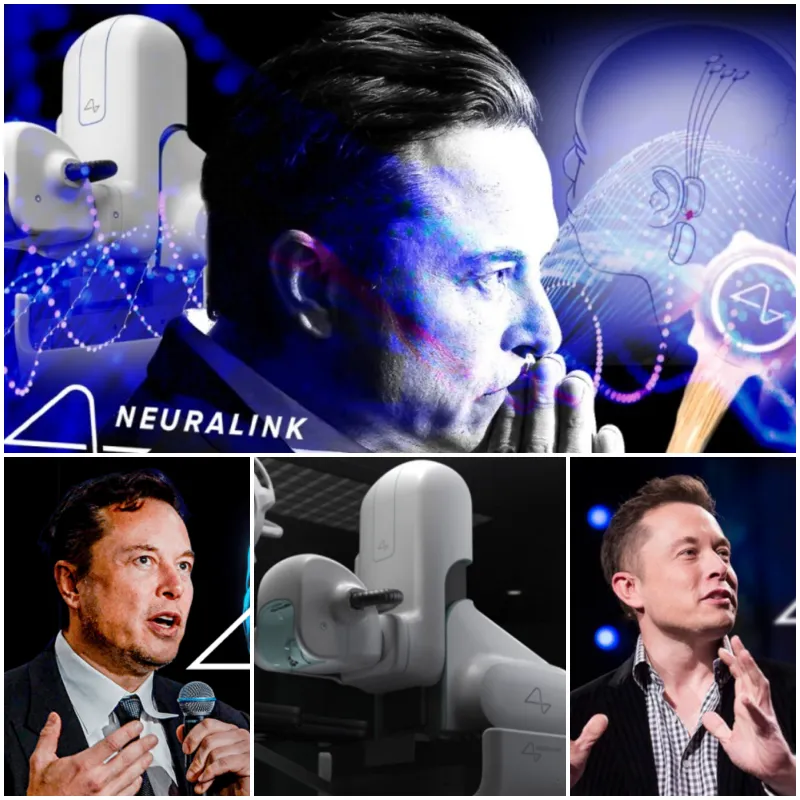 Elon Musk's Neuralink is approved brain implant testing in the US and Canada