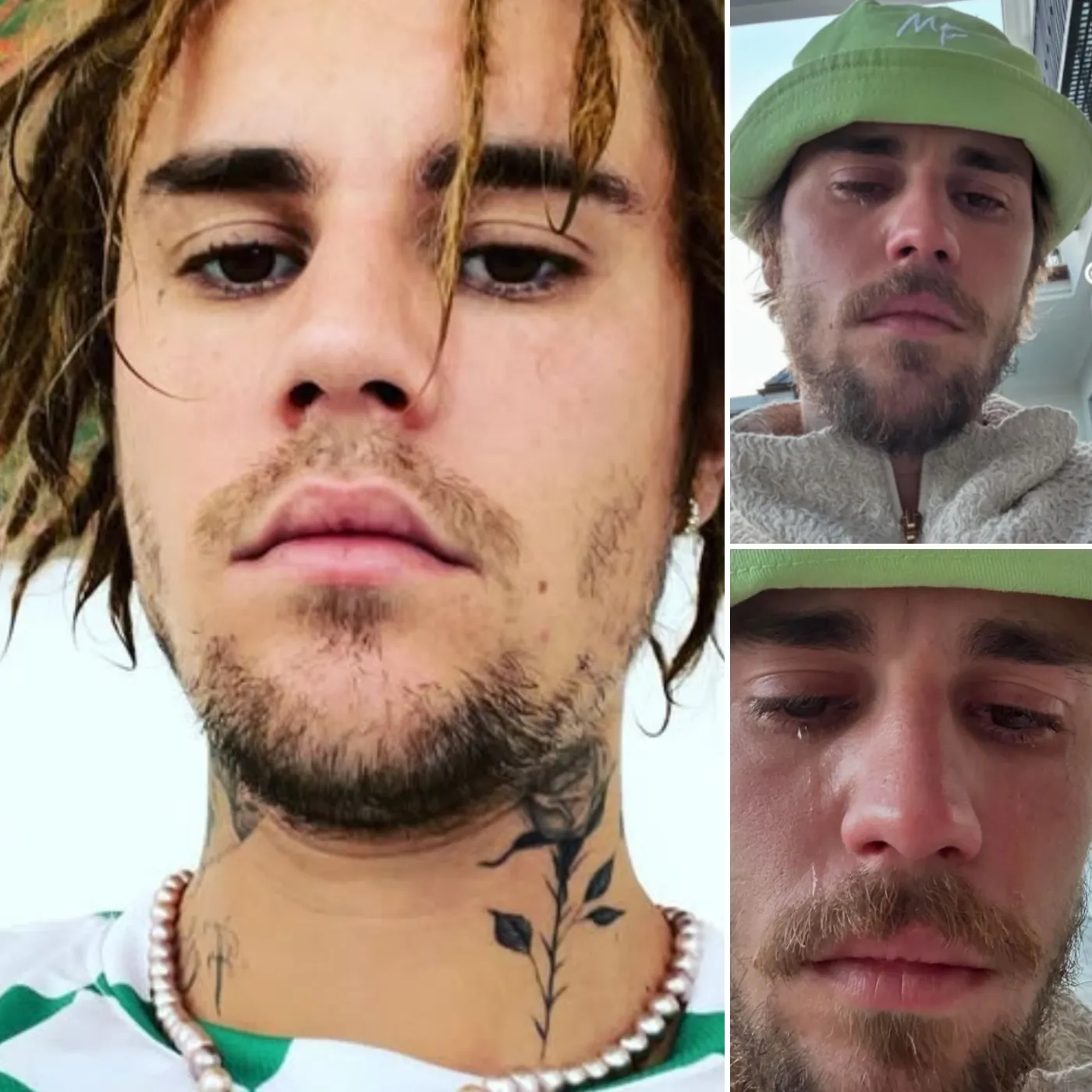 Justin Bieber’s Recent Breakdown: What Is REALLY Happening? You Will Be SHOCKED by the Truth!