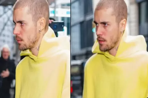 Justin Bieber Tampil Mengkhawatirkan di Tengah Isu Cerai dengan Hailey