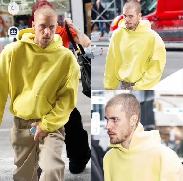 Justin Bieber’s Transformation: The Before and After That’s Breaking the Internet