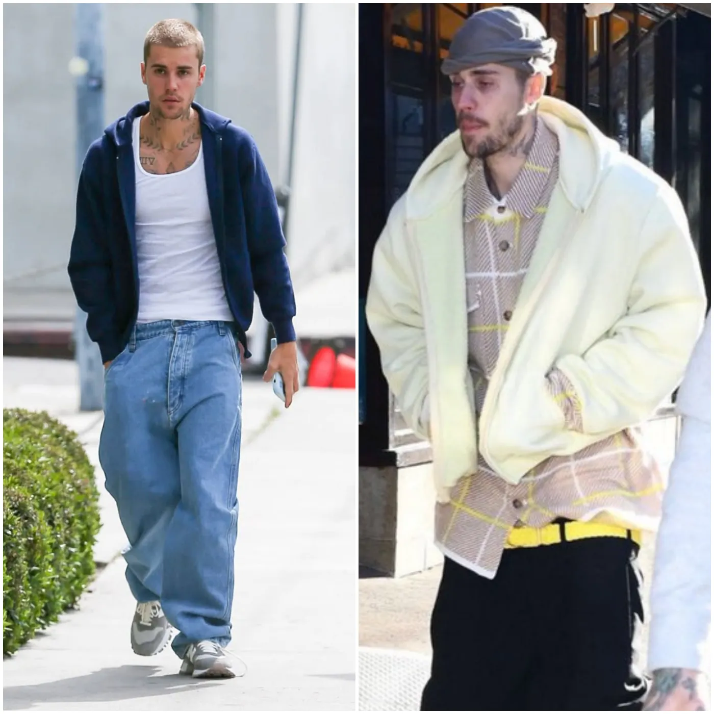 These shocking 'Before and After' Pictures of Justin Bieber Amid Divorce Rumors Have Fans Worried and Wondering: 'What Ever Became of Him?'