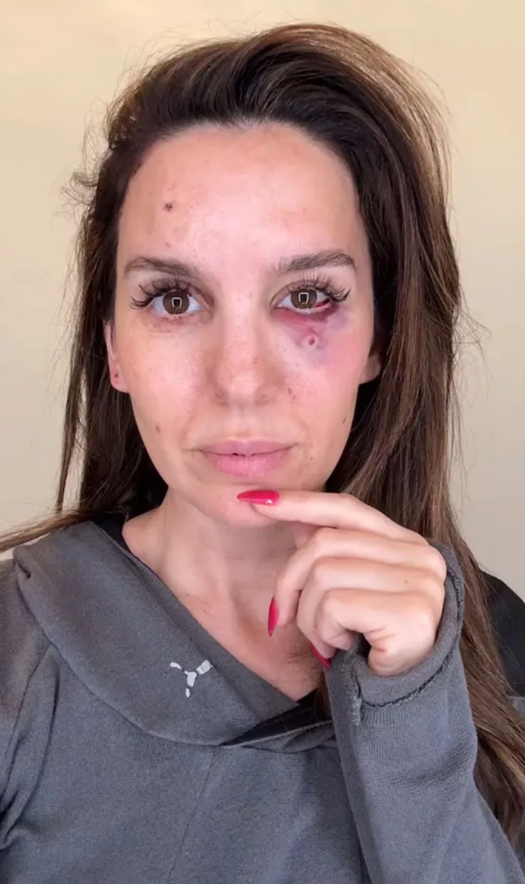 Christy Carlson Romano Hospitalized After Near-Tragic Shooting Accident