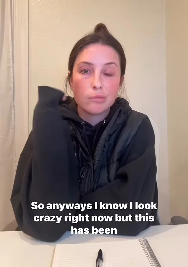 Bristol Palin Shares Concerning Health Update 23 Days After Facial Paralysis Diagnosis 2 Bristol Palin Shares Concerning Health Update 23 Days After Facial Paralysis Diagnosis