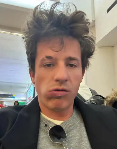 Is Charlie Puth Okay? His Tired Appearance Sparks Worry 2 Is Charlie Puth Okay? His Tired Appearance Sparks Worry