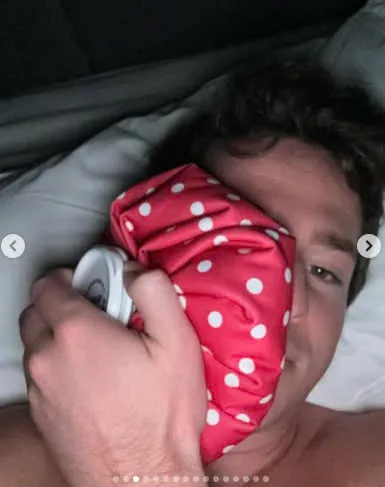 Is Charlie Puth Okay? His Tired Appearance Sparks Worry 3 Is Charlie Puth Okay? His Tired Appearance Sparks Worry