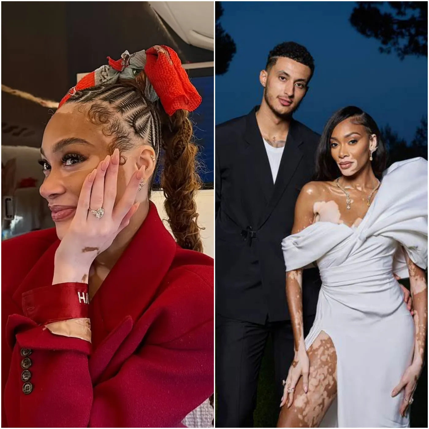 Winnie Harlow Gets Engaged in a Lavish Proposal on a Private Jet